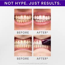 Hi-Smile v34 Original purple teeth whitening serum 30ML Stain Removal & Oral Cleaning